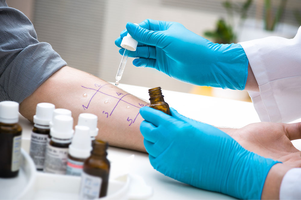 Testing Gluten Sensitivity – Key Symptoms, Methods, and Benefits